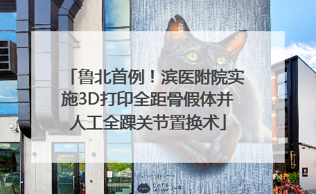 鲁北首例！滨医附院实施3D打印全距骨假体并人工全踝关节置换术